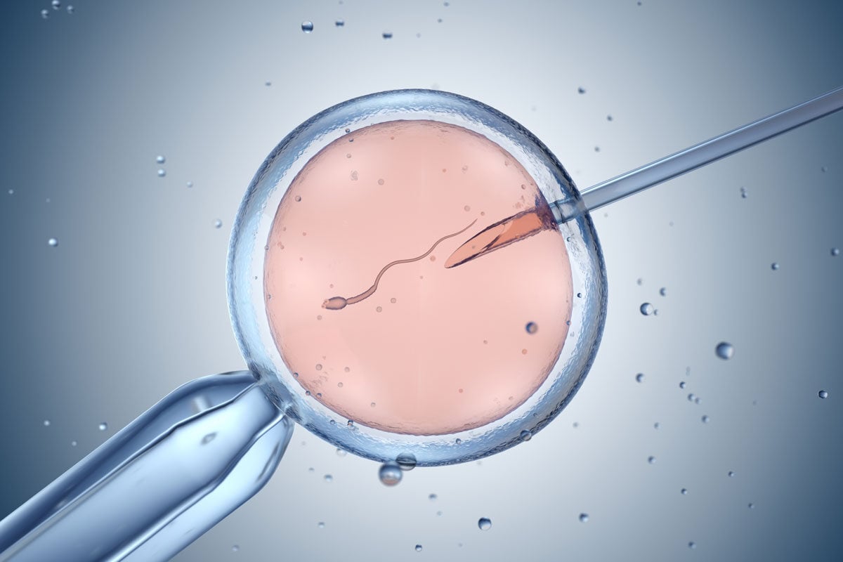 ivf-case-study